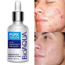 Serum Anti-Acné - Limpieza facial