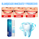 Lápiz Blanqueador De Dientes - Sonrisa radiante en cualquier momento