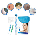 Kit Quita Verrugas + Accesorios