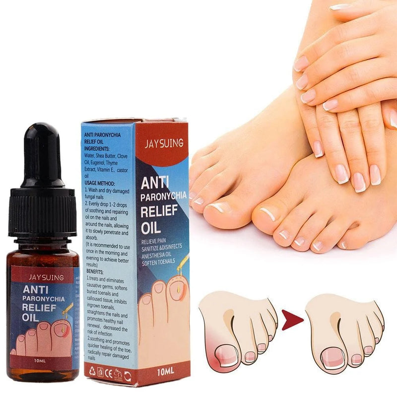 Anti Hongos Para Uñas - La Solución Eficaz para Uñas Saludables